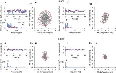 Incongruity of Geometric and Spectral Markers in the Assessment of Body Sway